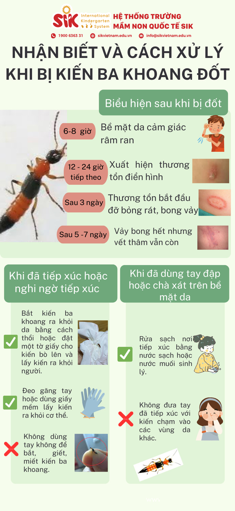KIẾN BA KHOANG - NỖI ÁM ẢNH MÙA MƯA 